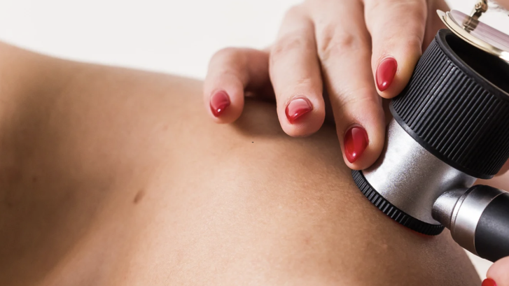 Skin Cancer Screening Appointments in Dunkirk Maryland